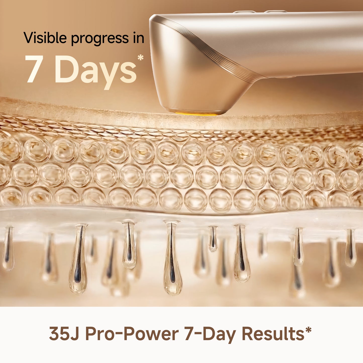 Dreame Astra IPL Home Use Hair Removal Device